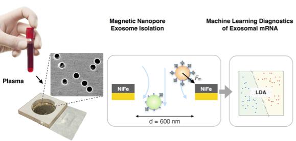 納米流控技術與機器學習相結合利用外泌體精確診斷胰腺癌